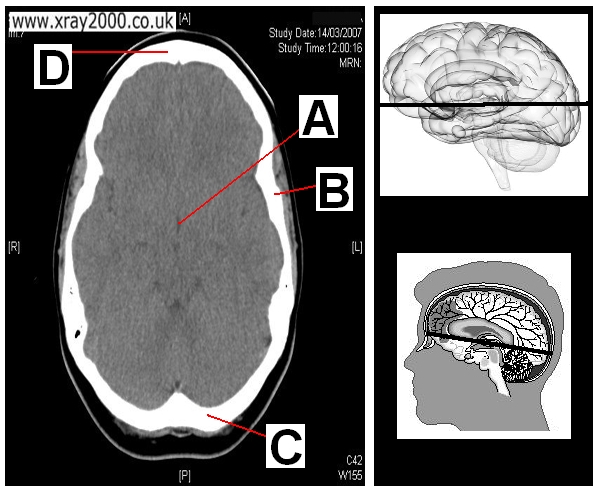 AXIAL SECTION 8.JPG